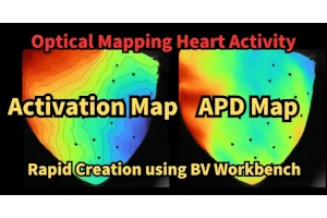 A Case Study on Rapid Creation of Activation Maps and APD Maps Using
                                BV Workbench