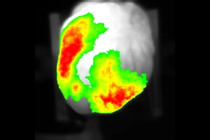 Voltage sensitive dye data | Cardiac samples