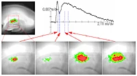 Action Potential Propagation