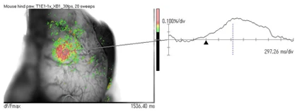 Example of flavoprotein imaging